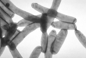The Legionella pneumophila bacteria